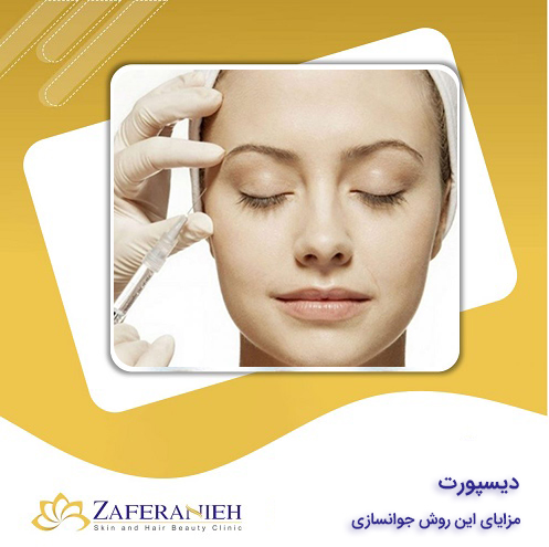 همه چیز درباره دیسپورت